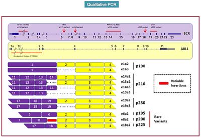 Monitoring Chronic Myeloid Leukemia: How Molecular Tools May Drive Therapeutic Approaches